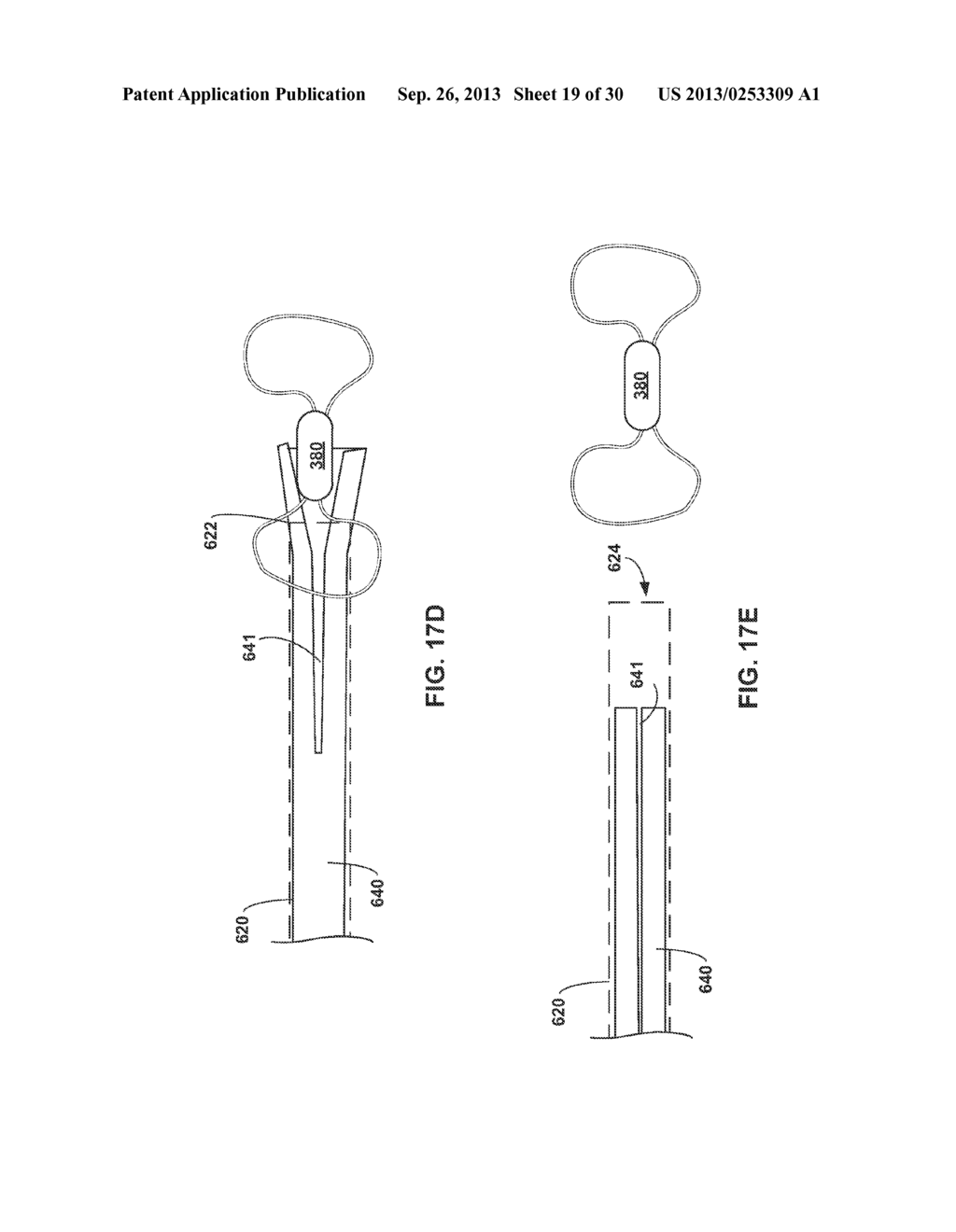 IMPLANTABLE MEDICAL DEVICE DEPLOYMENT WITHIN A VESSEL - diagram, schematic, and image 20