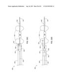 IMPLANTABLE MEDICAL DEVICE DEPLOYMENT WITHIN A VESSEL diagram and image