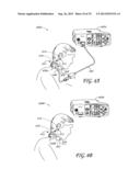 WIRELESS PATIENT MONITORING DEVICE diagram and image