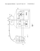 CARDIAC CYCLE SYNCHRONIZED SAMPLING OF IMPEDANCE SIGNAL diagram and image