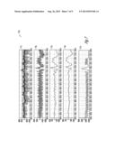 CARDIAC CYCLE SYNCHRONIZED SAMPLING OF IMPEDANCE SIGNAL diagram and image