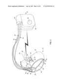 INTRAVASCULAR IMPLANTABLE MEDICAL DEVICE INTRODUCTION diagram and image