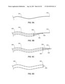 INTRAVASCULAR IMPLANTABLE MEDICAL DEVICE INTRODUCTION diagram and image