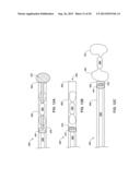 INTRAVASCULAR IMPLANTABLE MEDICAL DEVICE INTRODUCTION diagram and image