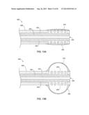 INTRAVASCULAR IMPLANTABLE MEDICAL DEVICE INTRODUCTION diagram and image