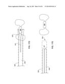 INTRAVASCULAR IMPLANTABLE MEDICAL DEVICE INTRODUCTION diagram and image