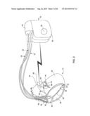 TETHERED IMPLANTABLE MEDICAL DEVICE DEPLOYMENT diagram and image