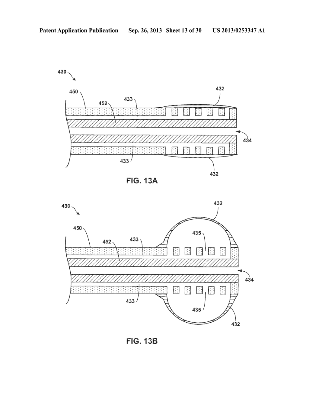 TETHERED IMPLANTABLE MEDICAL DEVICE DEPLOYMENT - diagram, schematic, and image 14