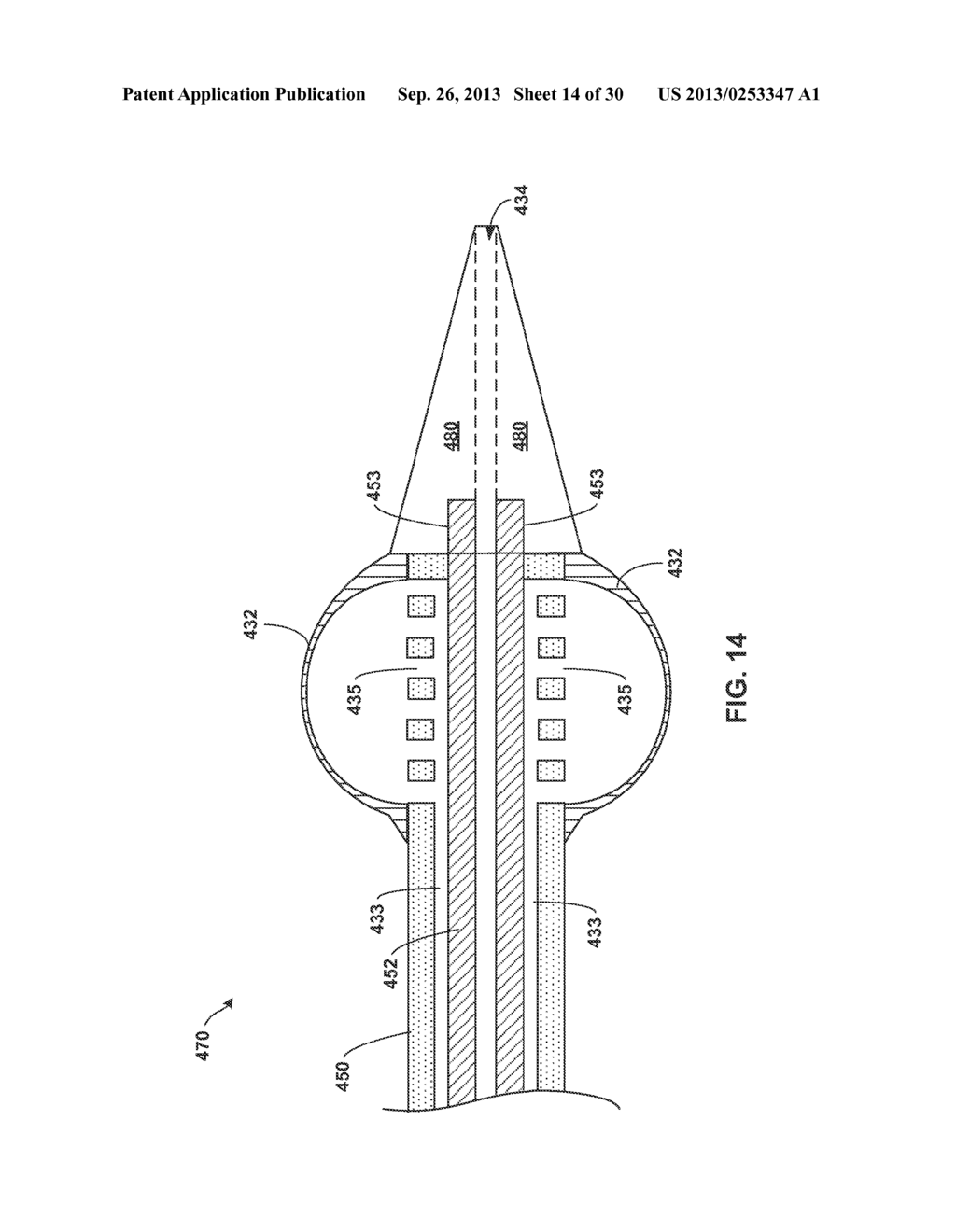 TETHERED IMPLANTABLE MEDICAL DEVICE DEPLOYMENT - diagram, schematic, and image 15