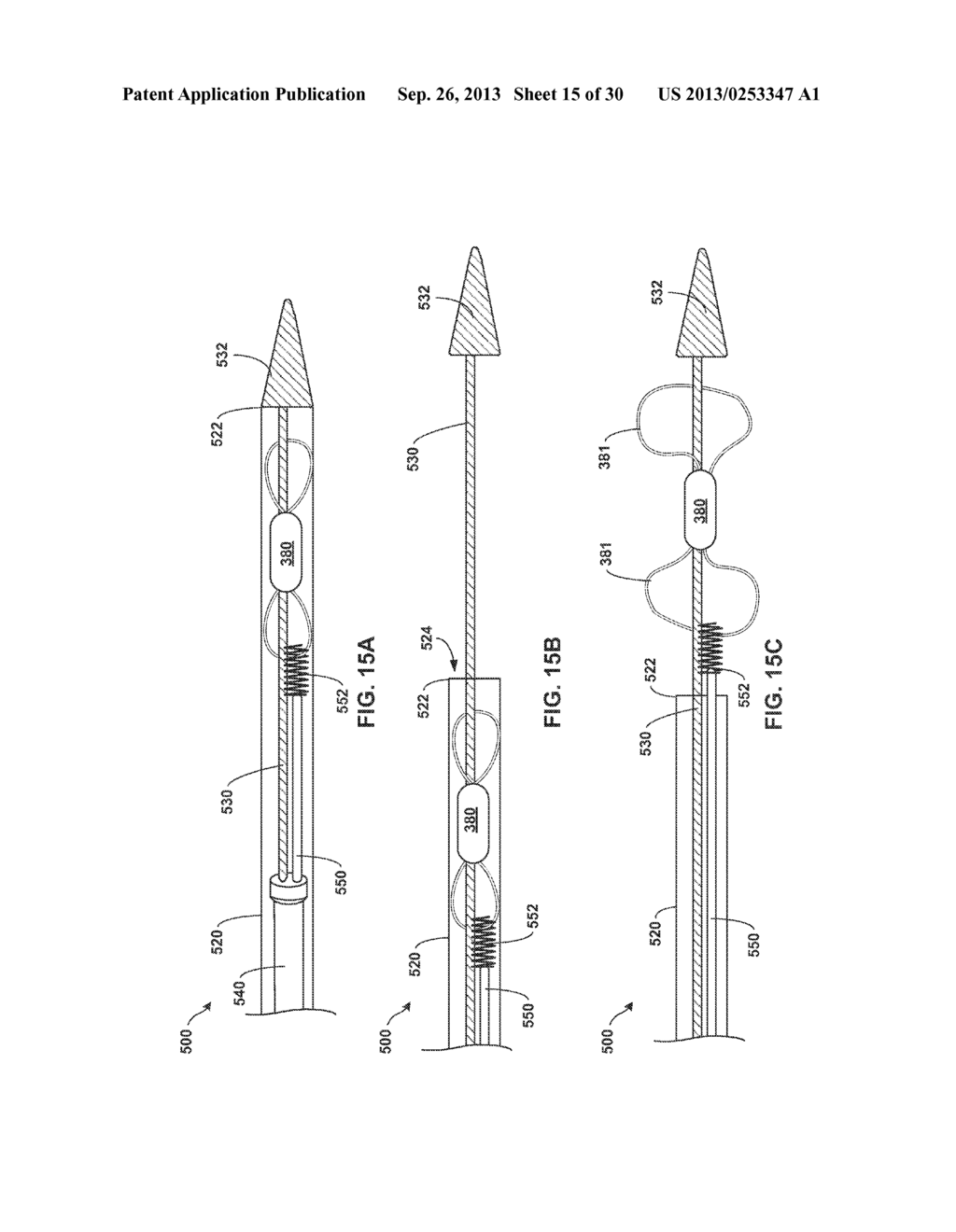 TETHERED IMPLANTABLE MEDICAL DEVICE DEPLOYMENT - diagram, schematic, and image 16