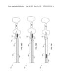 TETHERED IMPLANTABLE MEDICAL DEVICE DEPLOYMENT diagram and image