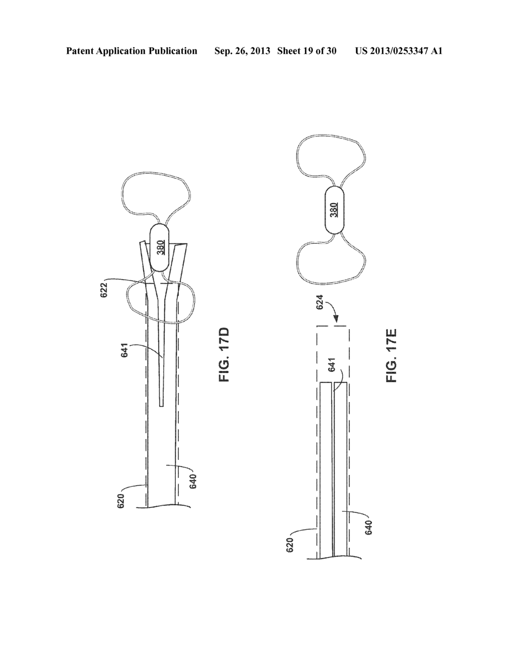 TETHERED IMPLANTABLE MEDICAL DEVICE DEPLOYMENT - diagram, schematic, and image 20