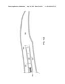 TETHERED IMPLANTABLE MEDICAL DEVICE DEPLOYMENT diagram and image