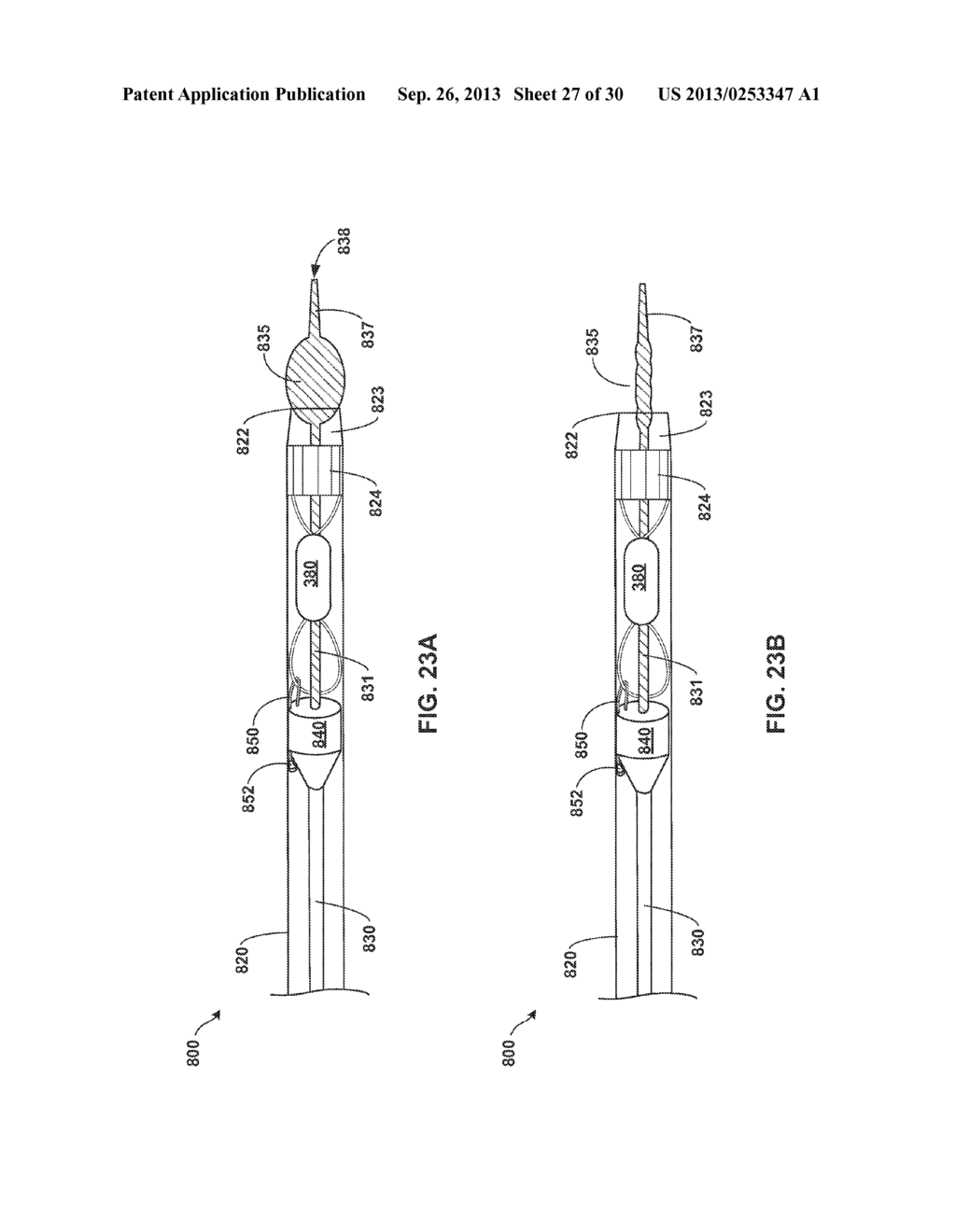 TETHERED IMPLANTABLE MEDICAL DEVICE DEPLOYMENT - diagram, schematic, and image 28