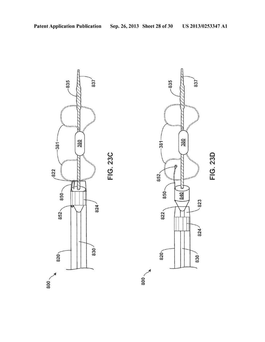 TETHERED IMPLANTABLE MEDICAL DEVICE DEPLOYMENT - diagram, schematic, and image 29