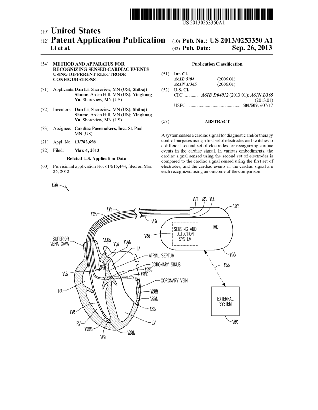 METHOD AND APPARATUS FOR RECOGNIZING SENSED CARDIAC EVENTS USING DIFFERENT     ELECTRODE CONFIGURATIONS - diagram, schematic, and image 01