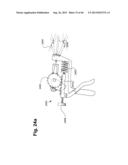 METHOD AND APPARATUS FOR PREVENTING VAGINAL LACERATIONS DURING CHILDBIRTH diagram and image