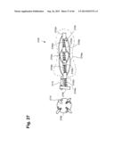 METHOD AND APPARATUS FOR PREVENTING VAGINAL LACERATIONS DURING CHILDBIRTH diagram and image