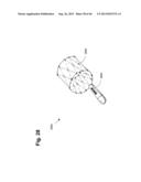 METHOD AND APPARATUS FOR PREVENTING VAGINAL LACERATIONS DURING CHILDBIRTH diagram and image