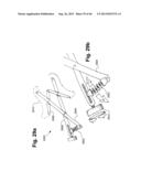 METHOD AND APPARATUS FOR PREVENTING VAGINAL LACERATIONS DURING CHILDBIRTH diagram and image