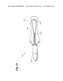 METHOD AND APPARATUS FOR PREVENTING VAGINAL LACERATIONS DURING CHILDBIRTH diagram and image