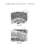 SYSTEMS FOR AFFECTING SUBCUTANEOUS LIPID-RICH CELLS, SYSTEMS FOR REMOVING     HEAT FROM SUBCUTANEOUS LIPID-RICH CELLS, AND SYSTEMS FOR REDUCING     SUBCUTANEOUS LIPID-RICH CELLS diagram and image