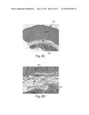 SYSTEMS FOR AFFECTING SUBCUTANEOUS LIPID-RICH CELLS, SYSTEMS FOR REMOVING     HEAT FROM SUBCUTANEOUS LIPID-RICH CELLS, AND SYSTEMS FOR REDUCING     SUBCUTANEOUS LIPID-RICH CELLS diagram and image