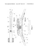 ORTHOPEDIC DEVICE diagram and image