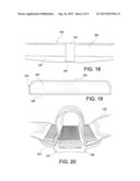 ORTHOPEDIC DEVICE diagram and image