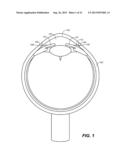 OCULAR DELIVERY SYSTEMS AND METHODS diagram and image