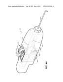 OCULAR DELIVERY SYSTEMS AND METHODS diagram and image