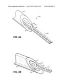 OCULAR DELIVERY SYSTEMS AND METHODS diagram and image