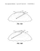 OCULAR DELIVERY SYSTEMS AND METHODS diagram and image