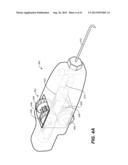 OCULAR DELIVERY SYSTEMS AND METHODS diagram and image