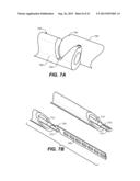 OCULAR DELIVERY SYSTEMS AND METHODS diagram and image