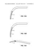 OCULAR DELIVERY SYSTEMS AND METHODS diagram and image