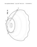 OCULAR DELIVERY SYSTEMS AND METHODS diagram and image