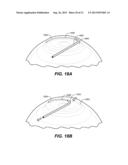 OCULAR DELIVERY SYSTEMS AND METHODS diagram and image