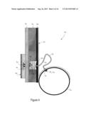 IMPLANTABLE FLUID MANAGEMENT DEVICE FOR THE REMOVAL OF EXCESS FLUID diagram and image