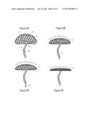 IMPLANTABLE FLUID MANAGEMENT DEVICE FOR THE REMOVAL OF EXCESS FLUID diagram and image