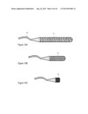 IMPLANTABLE FLUID MANAGEMENT DEVICE FOR THE REMOVAL OF EXCESS FLUID diagram and image