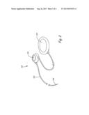 MEDICAL DEVICES TO FACILITATE TISSUE STABILIZATION FOR HEART FAILURE diagram and image