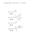 MEDICAL DEVICES TO FACILITATE TISSUE STABILIZATION FOR HEART FAILURE diagram and image