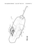 OCULAR DELIVERY SYSTEMS AND METHODS diagram and image