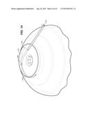 OCULAR DELIVERY SYSTEMS AND METHODS diagram and image