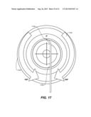 OCULAR DELIVERY SYSTEMS AND METHODS diagram and image