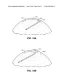 OCULAR DELIVERY SYSTEMS AND METHODS diagram and image