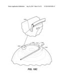 OCULAR DELIVERY SYSTEMS AND METHODS diagram and image