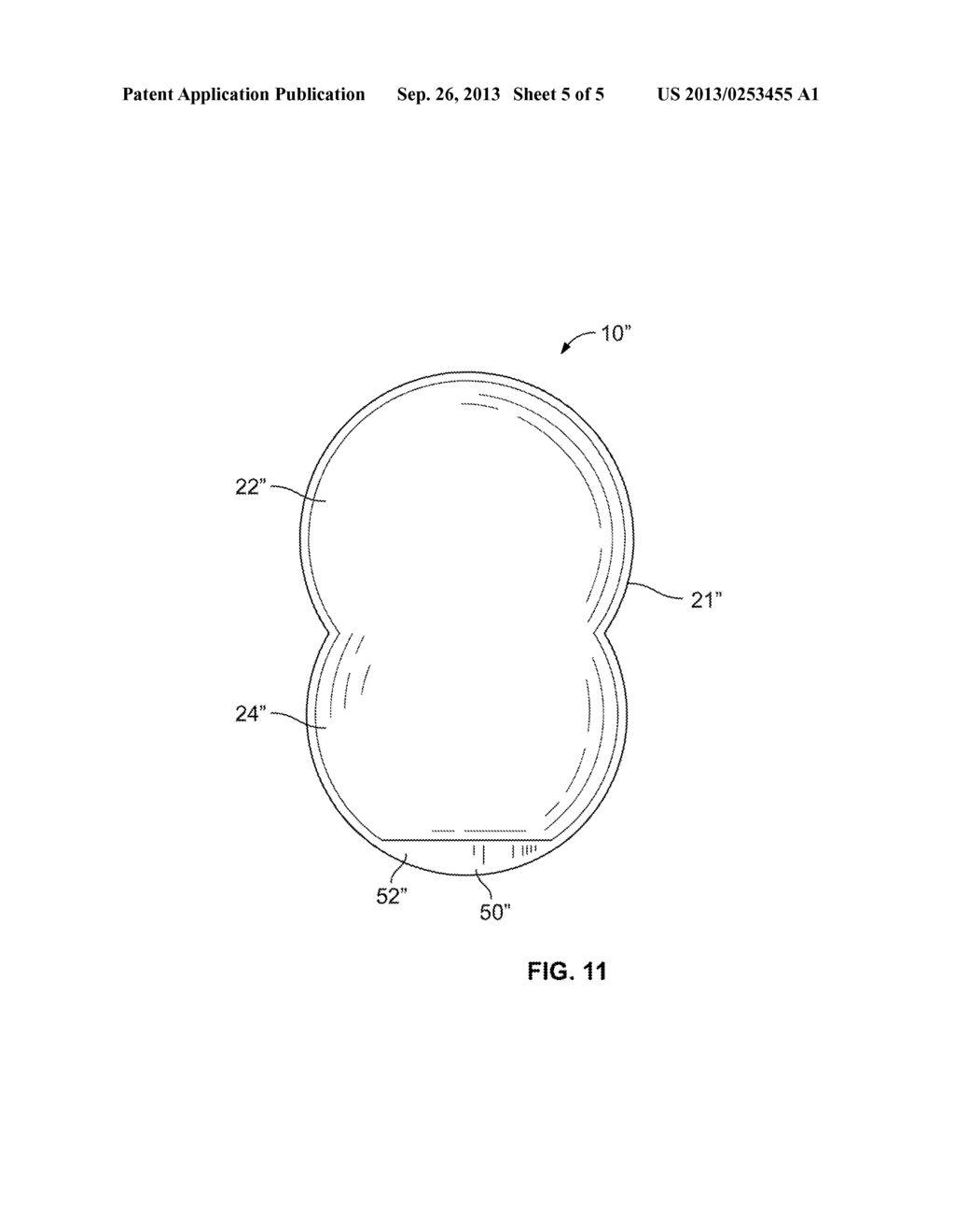 EXPANDABLE OSTOMY APPLIANCE - diagram, schematic, and image 06