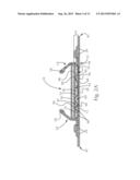 Article with Nonwoven Web Component Formed with Loft-Enhancing Calender     Bond Shapes and Patterns diagram and image